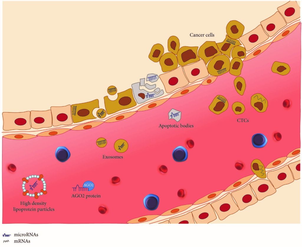 Noncoding RNAs as Novel Biomarkers in Prostate Cancer by C. G. H. Rönnau, G. W. Verhaegh, M. V. Luna-Velez and J. A. Schalken